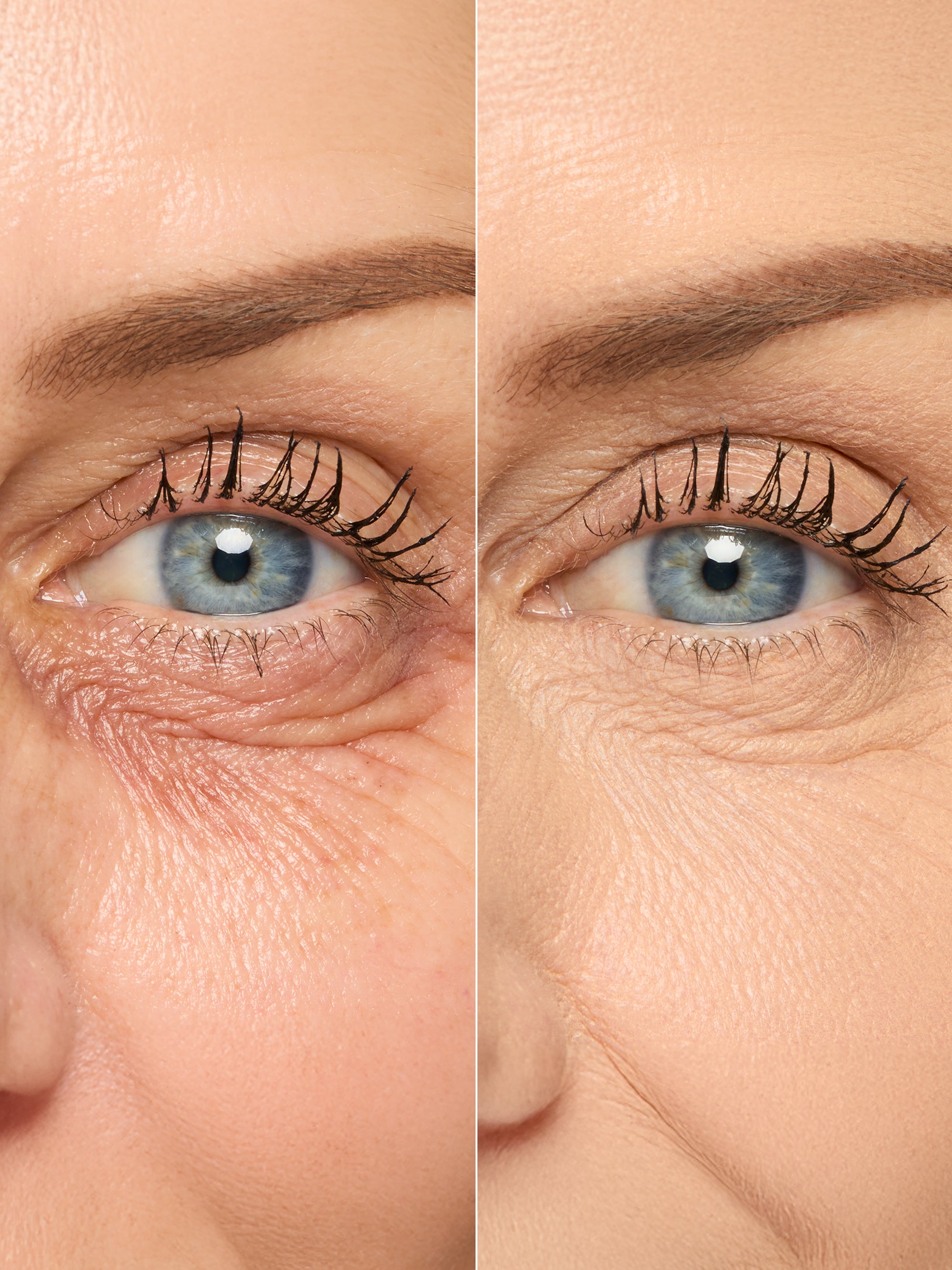 An eye is shown in a split-image comparison. The left side highlights prominent wrinkles, while the right side appears smoother, suggesting a cosmetic effect in skin texture improvement.
