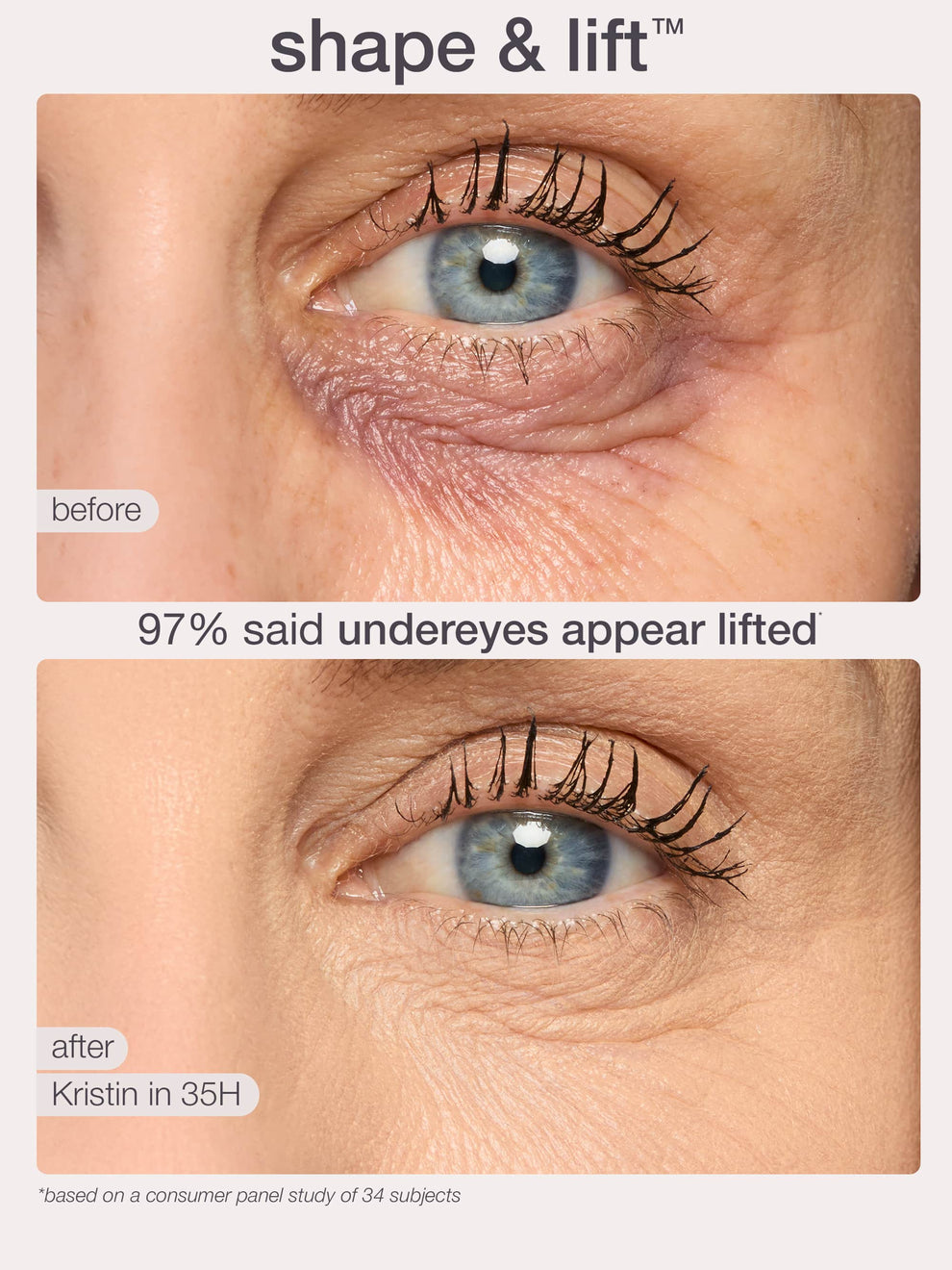 Before and after comparison of eye area with text indicating lift effect and consumer panel study results.
