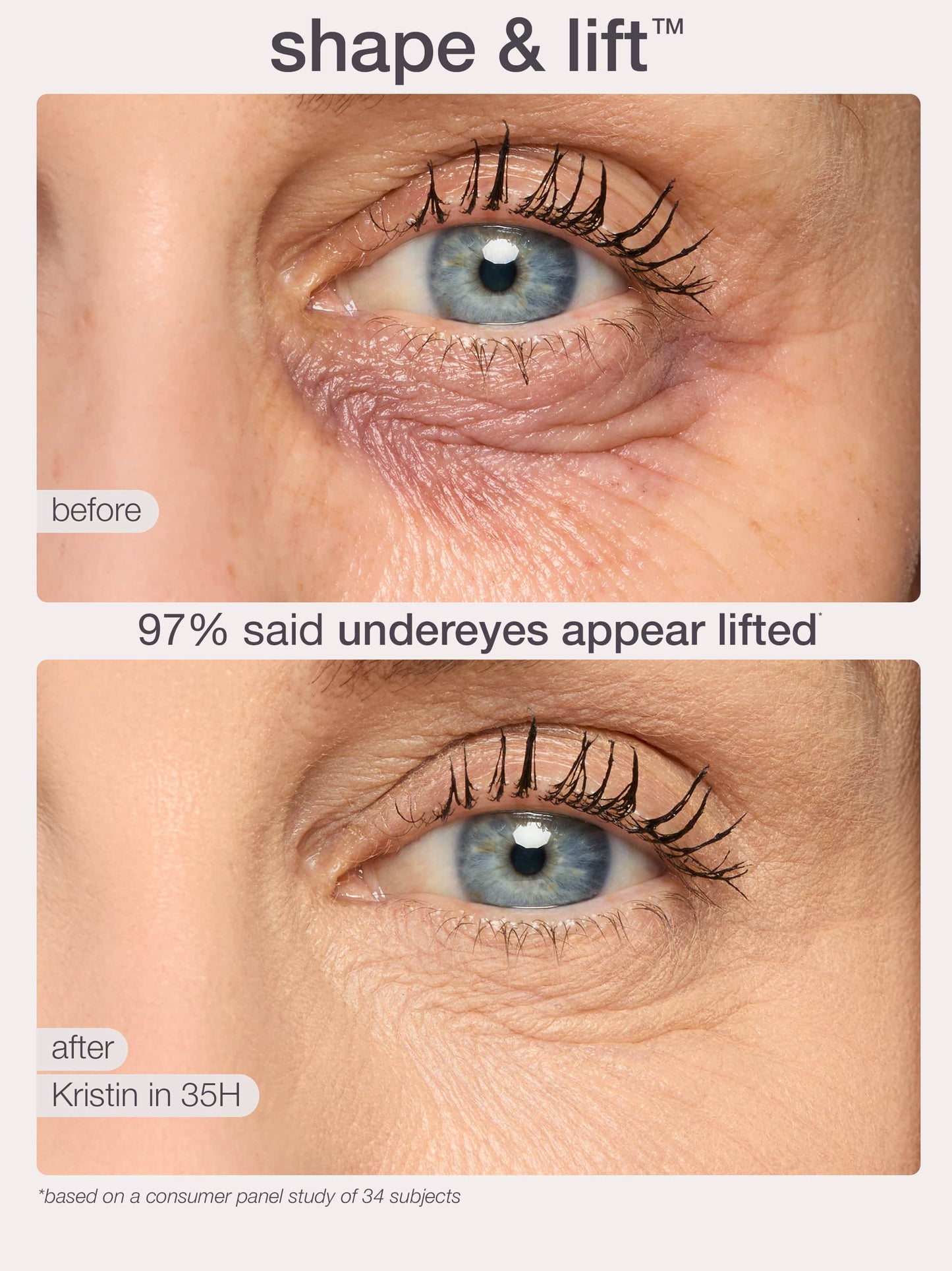 Before and after comparison of eye area with text indicating lift effect and consumer panel study results.