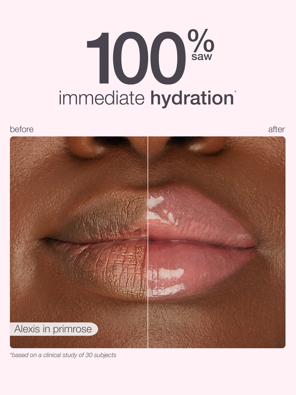 Before and after comparison of lips with immediate hydration, labeled '100% saw'.
