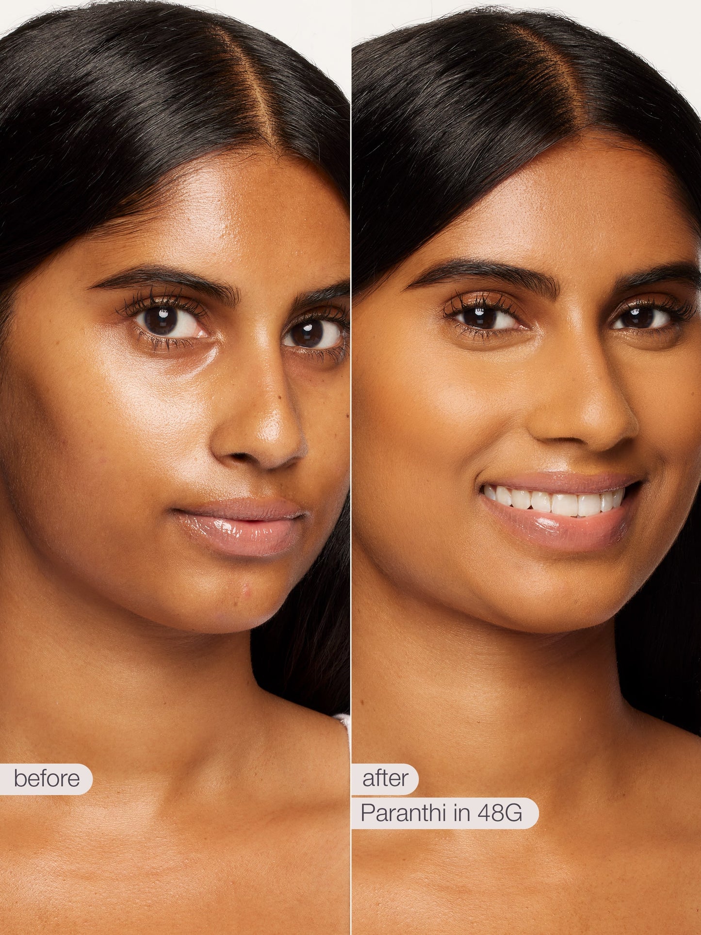 Before and after comparison of a woman's face with Paranthi in 48G application.