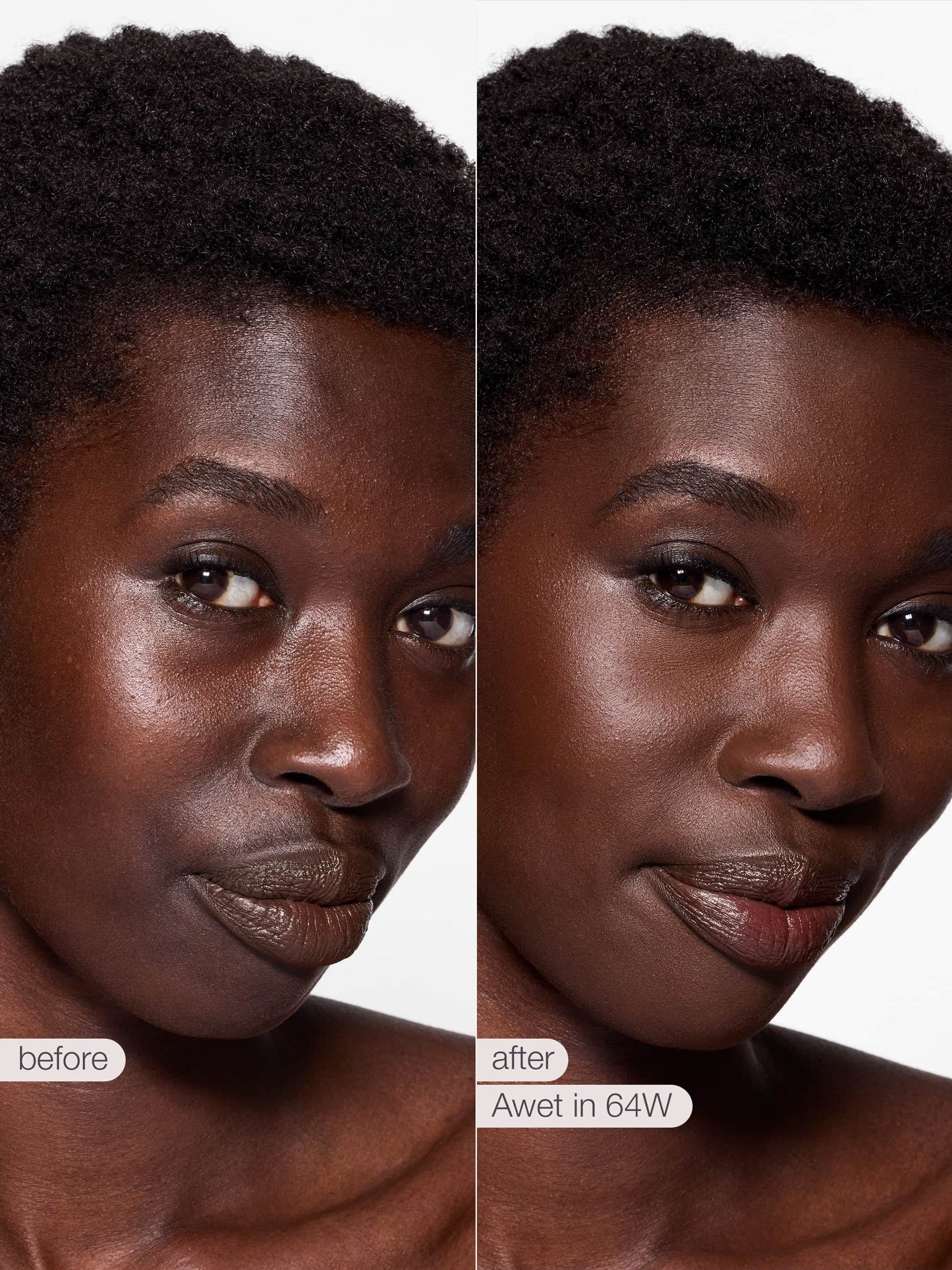 Before and after comparison of a woman's face with text indicating a treatment or product name.