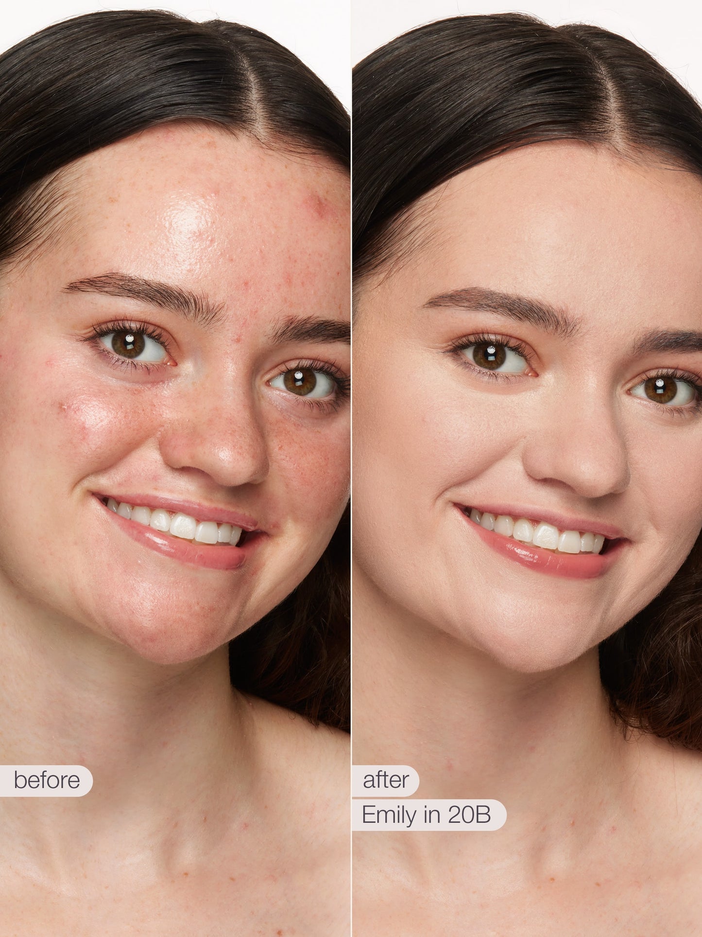 Before and after comparison of a woman's face with visible skin treatment effects.