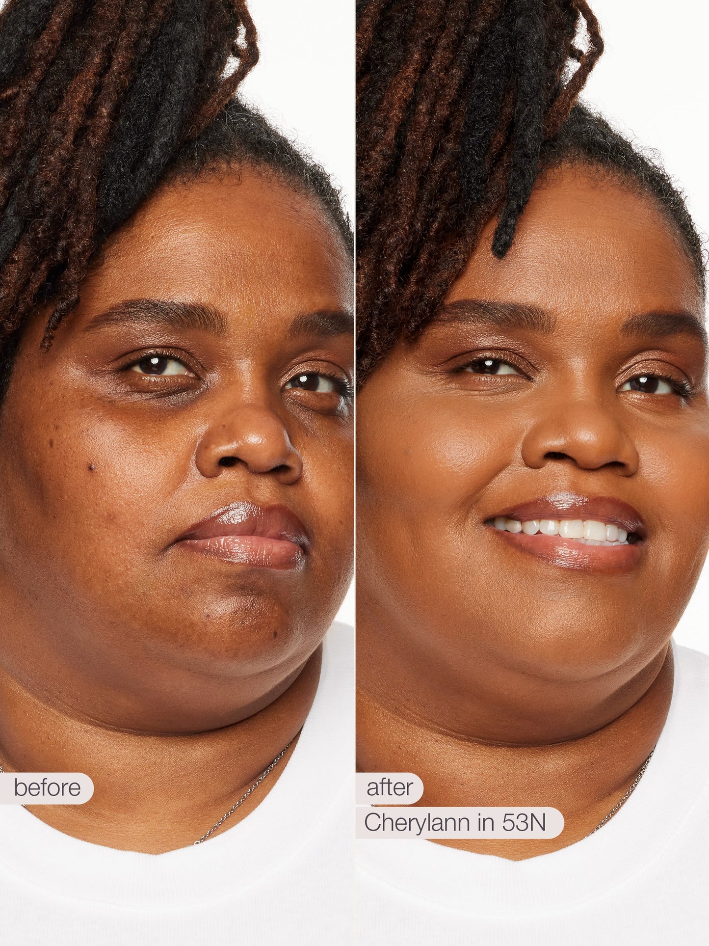 Before and after comparison of a person with text indicating a cosmetic procedure.
