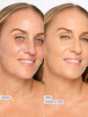 Before and after comparison of a woman's face with visible skin improvement, labeled 'Kristin' and '35H'.
