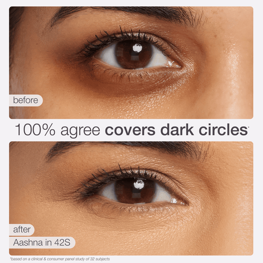Two close-up images of a person's eye: one before showing dark circles, and one after with even skin tone. Text: 100% agree covers dark circles. Aashna in 42S. Based on a study of 32 subjects.